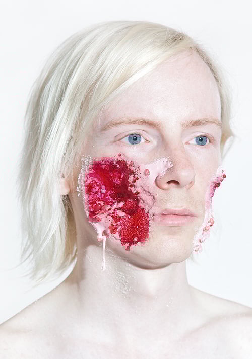 Portraits Of Severe Face Injuries Made With Cake, Candy & Ice Cream