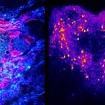 Endocrine Images Art Competition