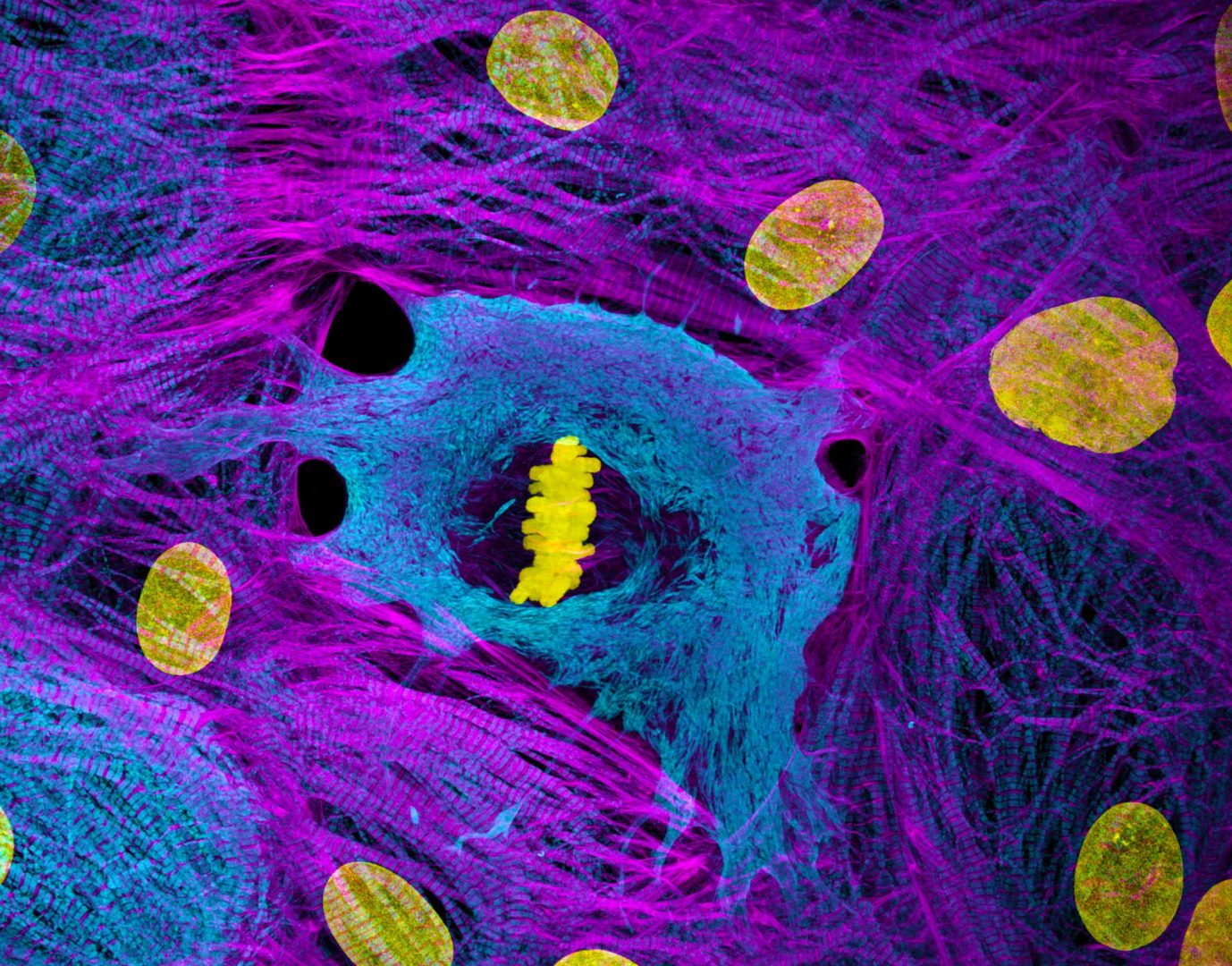 Nikon Small World 2025