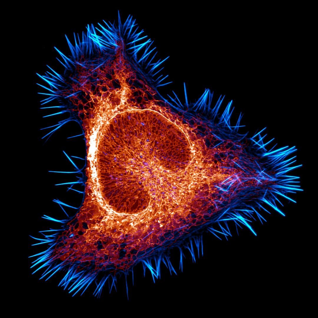 microscopic photography contest