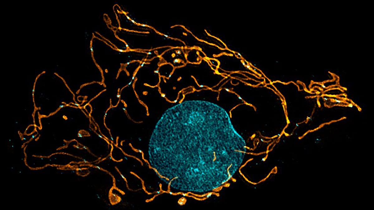 This microscope can see inside living cells at a sub-zero temperature cover